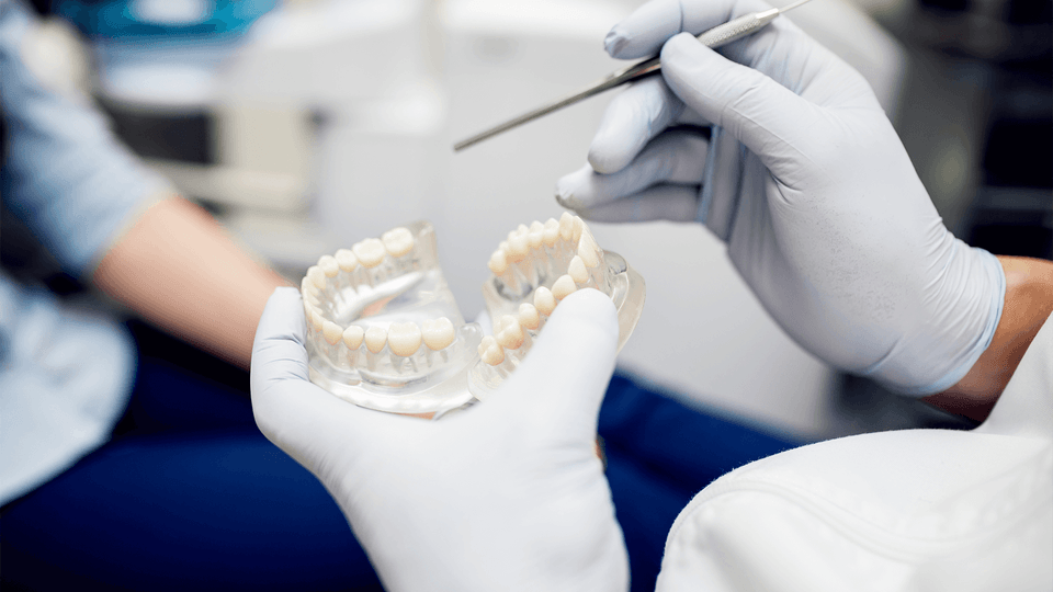 Dental Crowns in Riverside At Dental Specialists of Riverside Mean ...