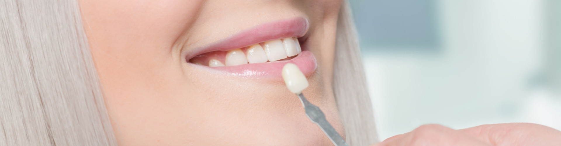 smiling woman having veneers color matched to her teeth.