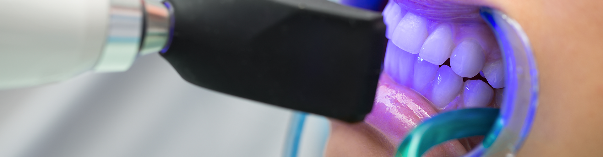 led light shining on teeth in open mouth.