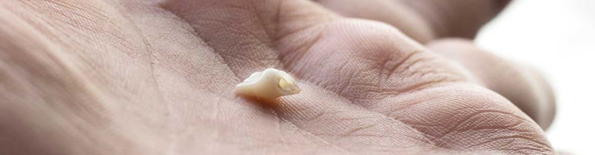 Hand with a chipped tooth in palm.