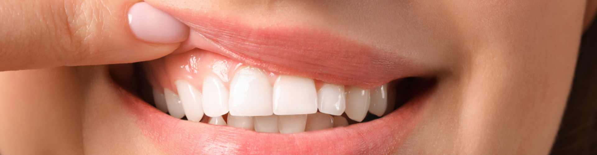 female lifting lip to show healthy gums.