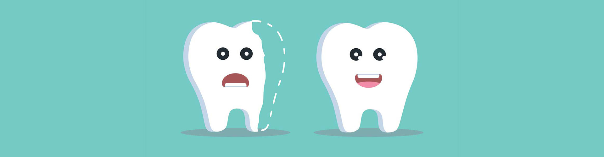illustration of two teeth, one smiling and one frowning and chipped.
