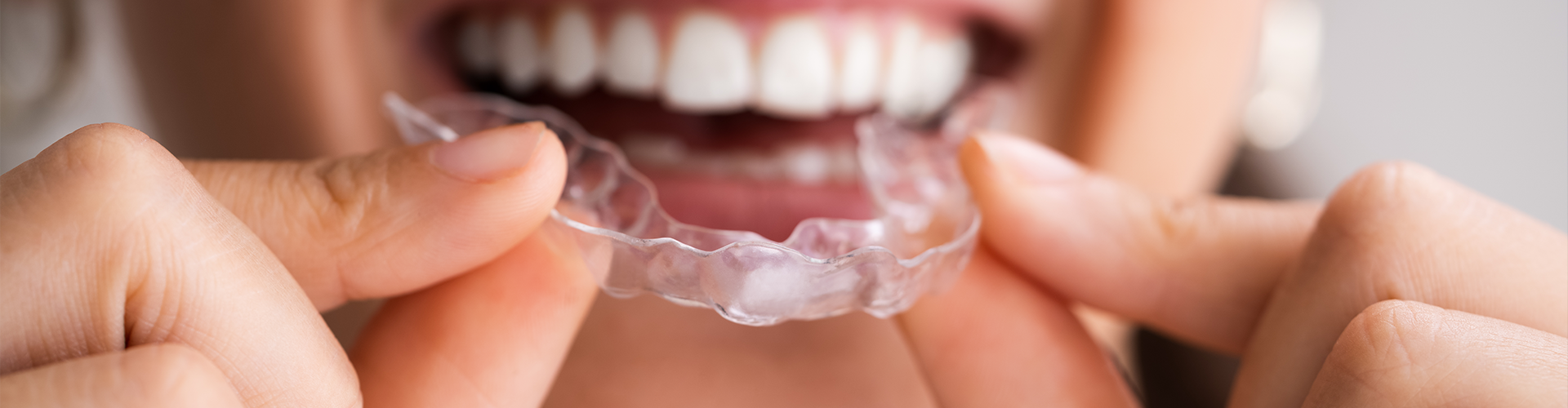 woman placing clear alinger into her mouth.