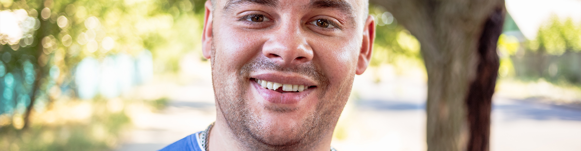 man smiling with a broken upper tooth.