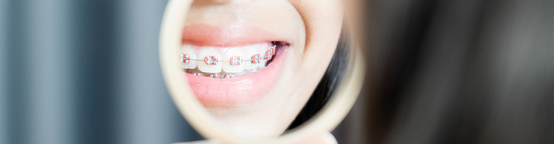 smile with braces reflected in hand mirror.