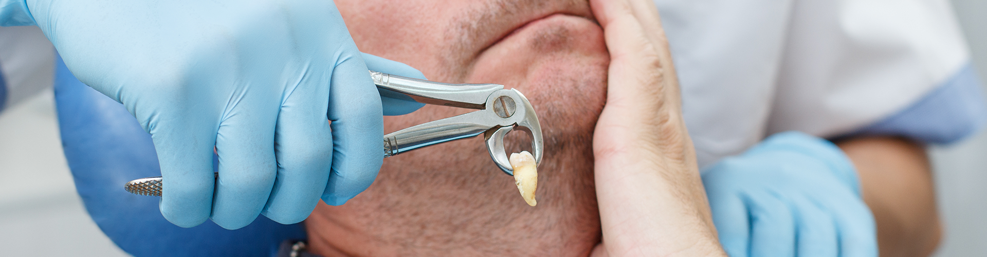 tooth held in pliers in front of patient holding his cheek.