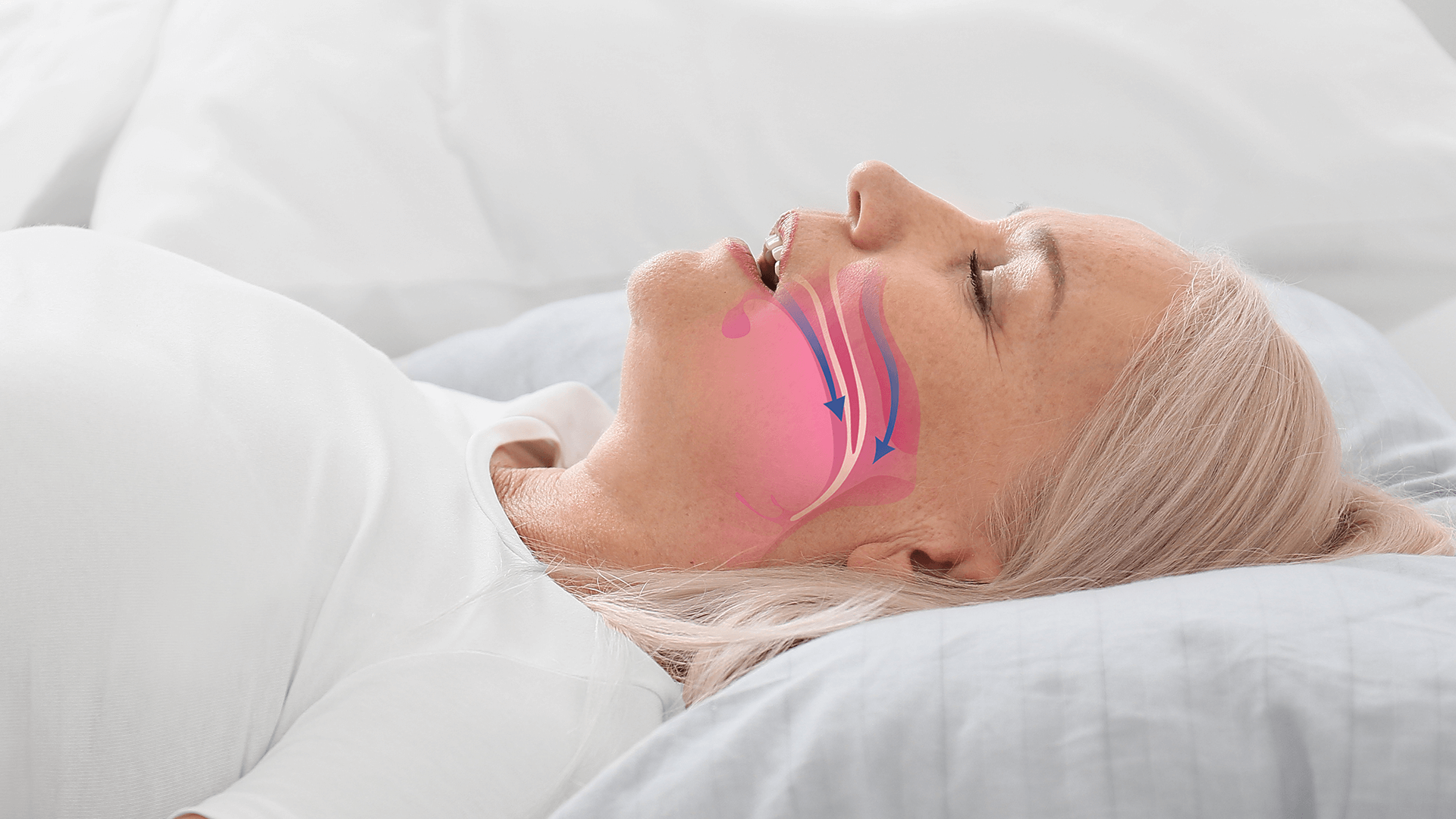 Woman with sleep apnea in explanation.