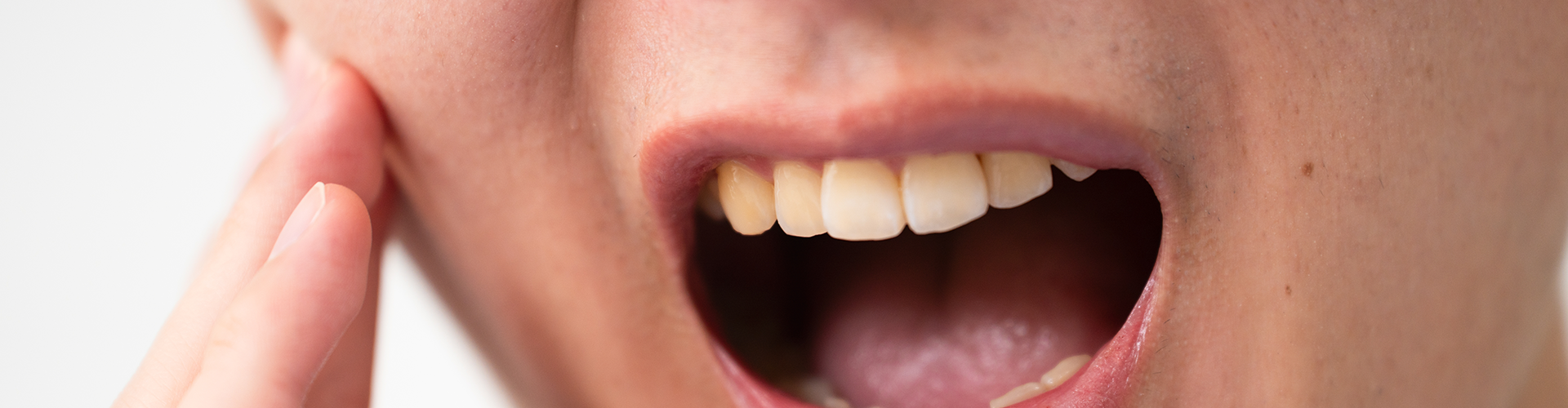 woman holding cheek in pain.