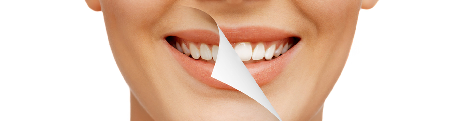 Woman's face smiling with half of being pulled down with a piece of paper half the teeth are white and half are more yellow.