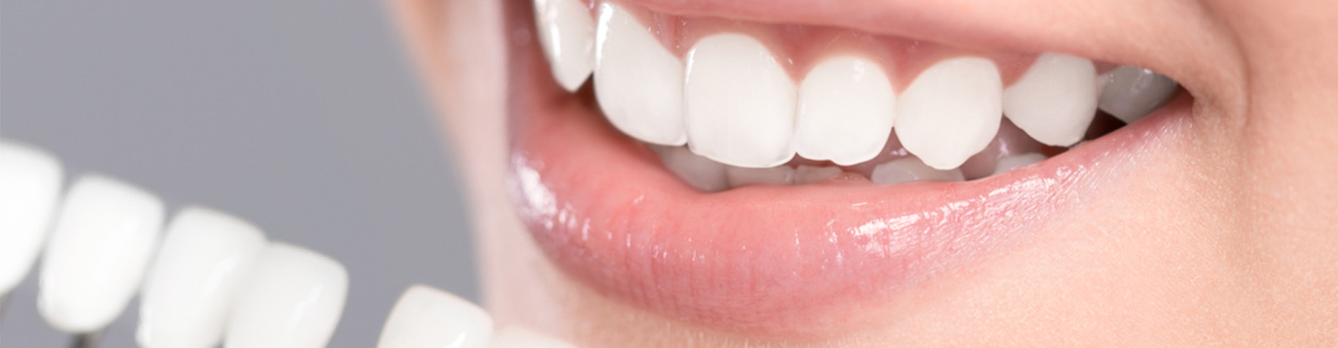Woman smiling with a tooth tray of different shades of white teeth.
